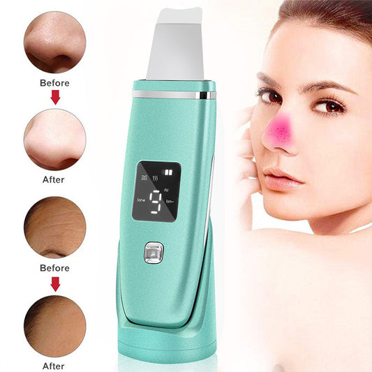 Ultrasonic Pore Cleaner and Blackhead Remover Tool